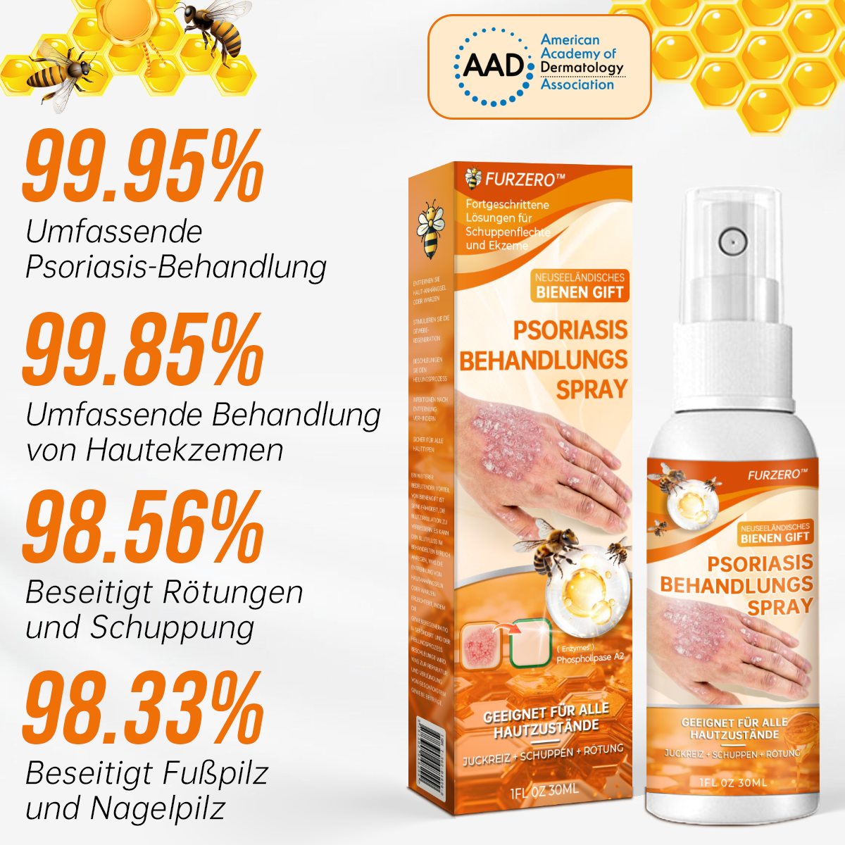 1+1 GRATIS | Psoriasisbehandelingsspray, bevrijd uw huid vandaag nog!