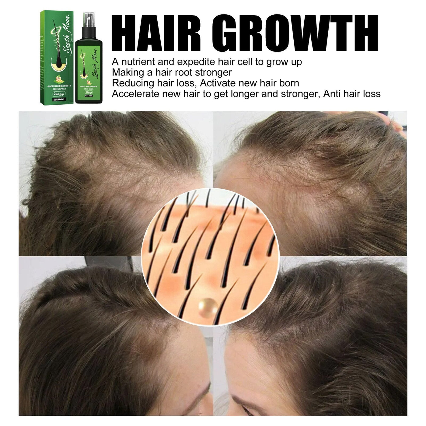 1+1 GRATIS I GrowthPlus™ Voedende Gember Spray