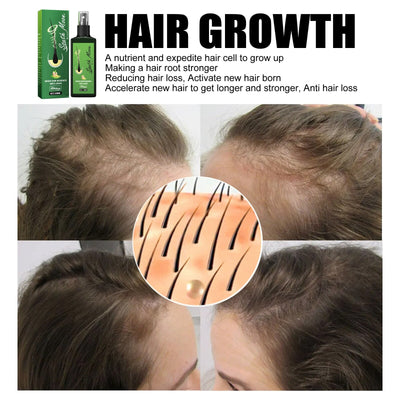 1+1 GRATIS I GrowthPlus™ Voedende Gember Spray