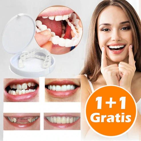 SmileFix™ - Creëer het perfecte gebit | ALLEEN VANDAAG 1+1 GRATIS